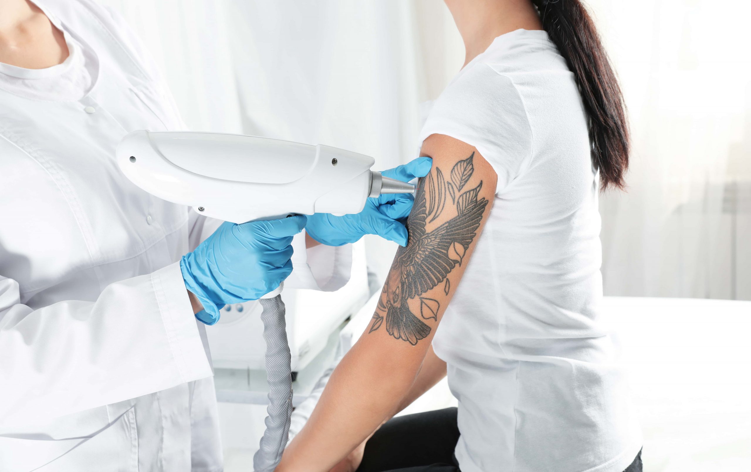 Skin and You  Painless Tattoo Removal