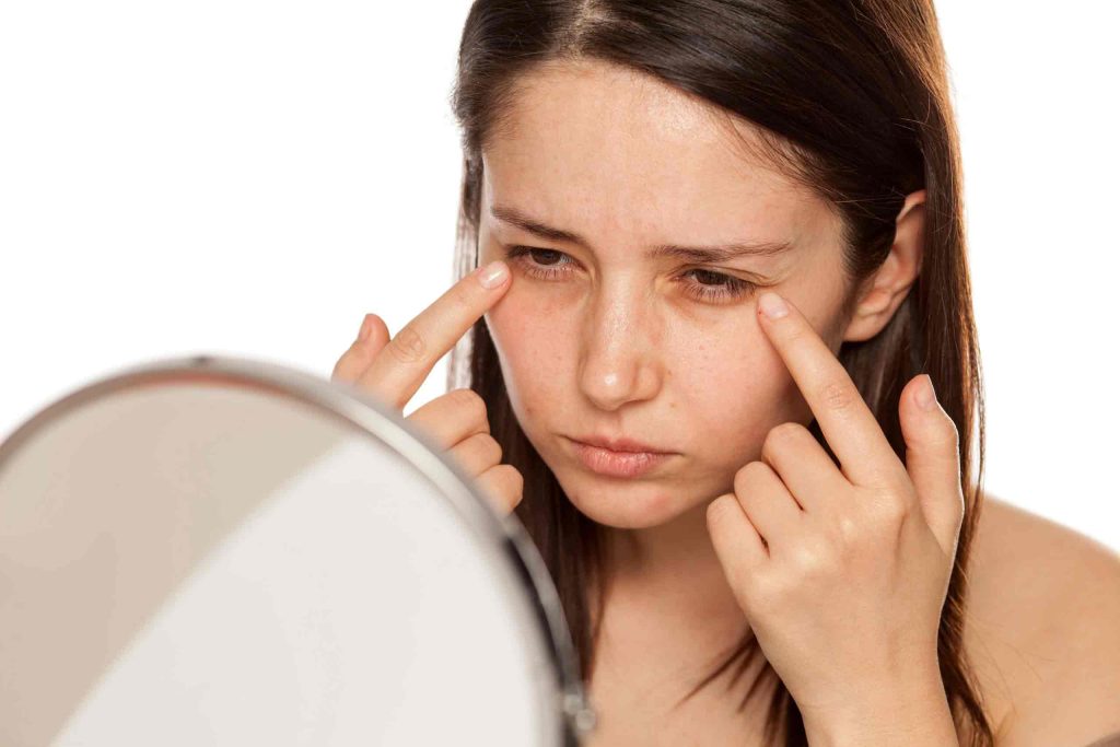 Under Eye Bags: Causes, Symptoms, Home Remedies and Treatment