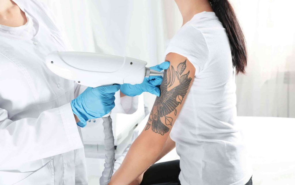 Breaking up With Your Tattoo Why Laser Tattoo Removal Treatments Are on  the Rise  Laser NY