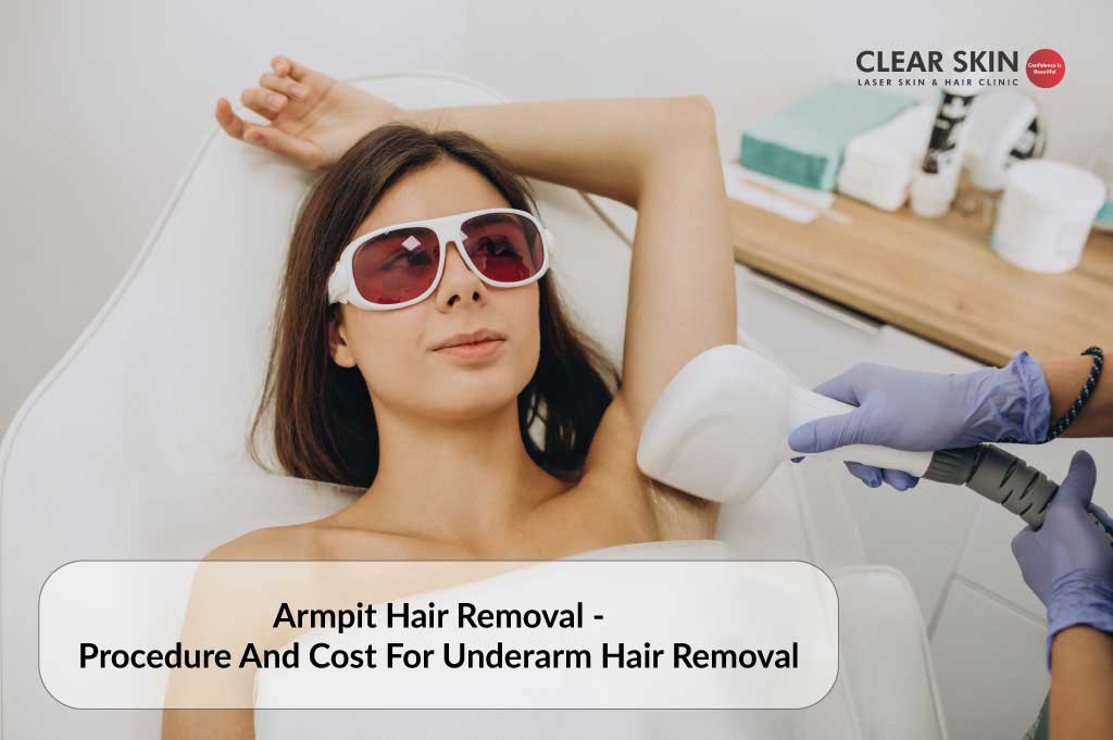 Underarm Laser Hair Removal in Dubai & Abu Dhabi | Cost & Prices