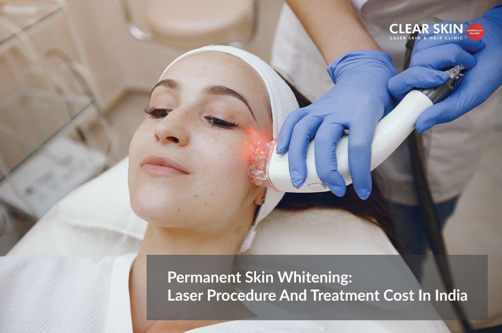 Permanent Skin Whitening: Laser Procedure and Treatment Cost in India