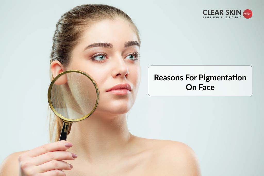 Main Reason For Pigmentation On Face