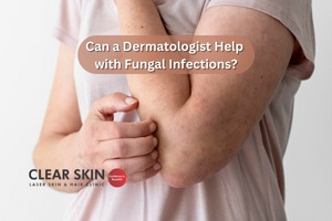 Can a Dermatologist Help with Fungal Infections?