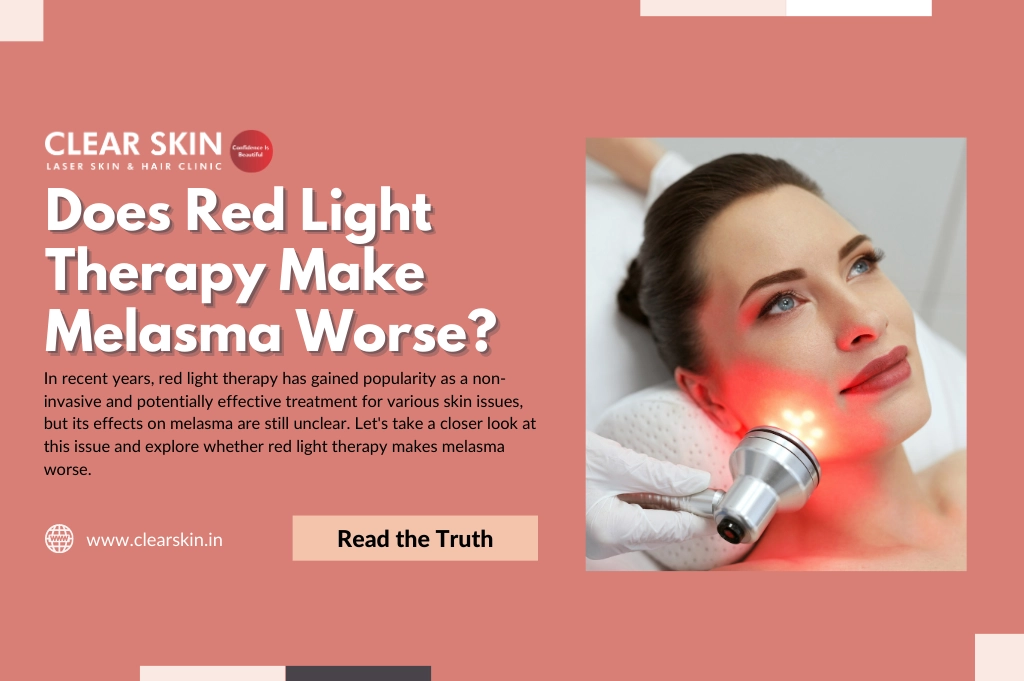 Does Red Light Therapy Make Melasma Worse?