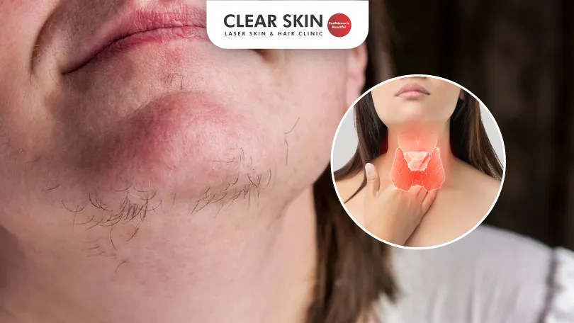 Laser Hair Removal Treatment in Thane (Call: 9321525677)- Best Laser Hair  Removal Treatment in Thane