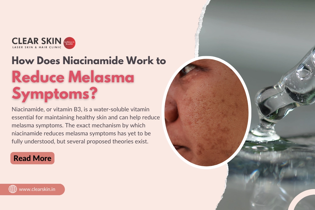 How Does Niacinamide Work to Reduce Melasma Symptoms?