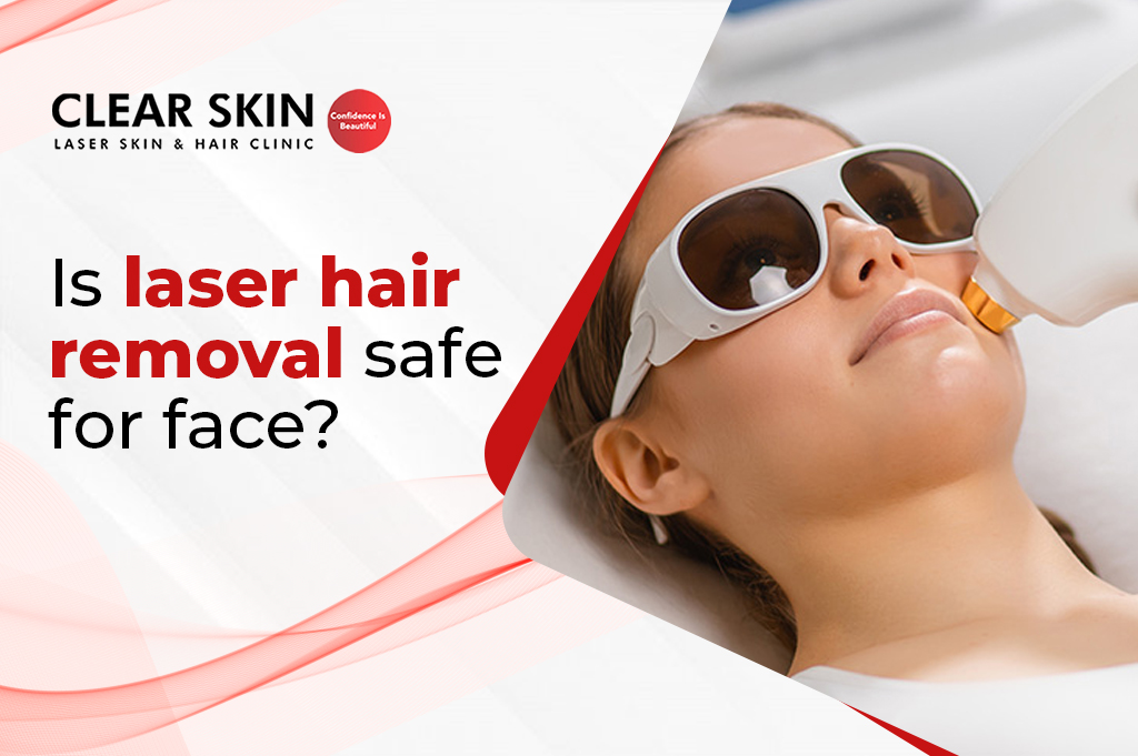 Laser Facial Hair Removal Treatment: Your Ultimate Guide!
