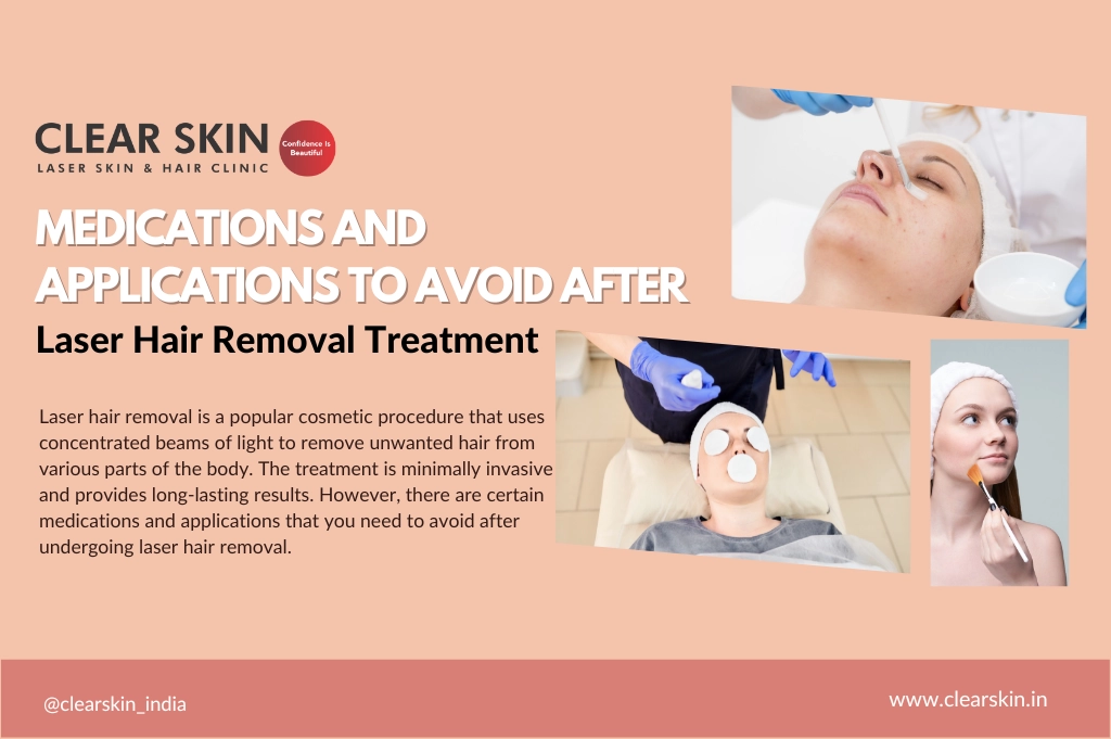 Medications and Applications to Avoid After Laser Hair Removal Treatment