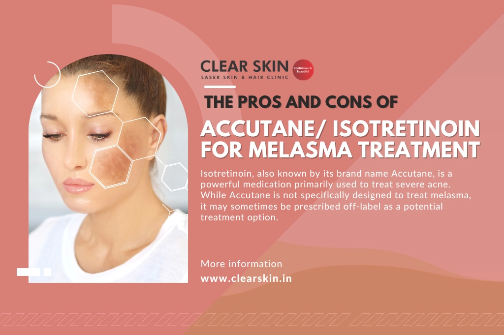 Pros and Cons of Accutane Isotretinoin for Melasma Treatment