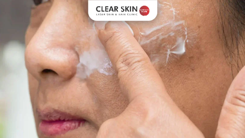 Top 64+ hydrocortisone cream on tattoo 3tdesign.edu.vn