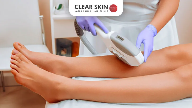 Can Laser Treatment Remove Hair Permanently Clear Skin Pune