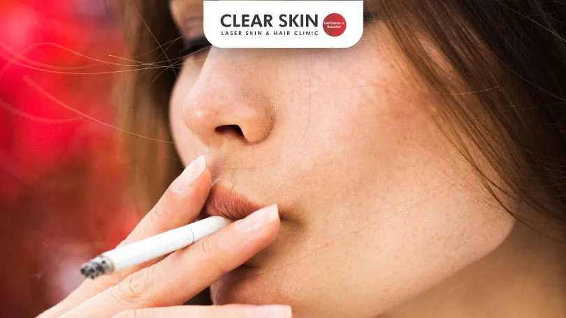 Does Smoking Cause Melasma Clear Skin Pune