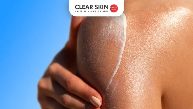 does sunscreen reduce tan