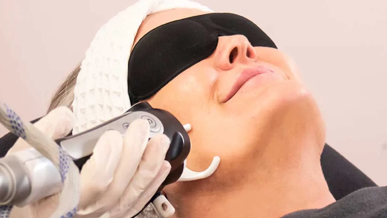 Fractional-Laser-Skin-Resurfacing-Treatment Fractional Laser Skin Resurfacing Treatment
