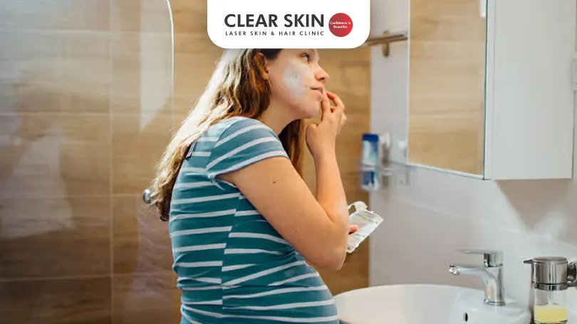 How-to-Deal-with-Melasma-After-Pregnancy-Clear-Skin-Pune how to deal with melasma after pregnancy