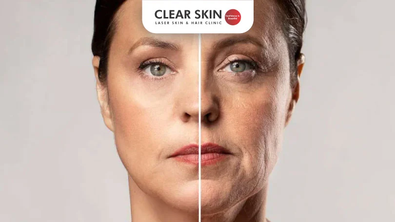 How to Tighten Loose Skin on Face clear skin pune