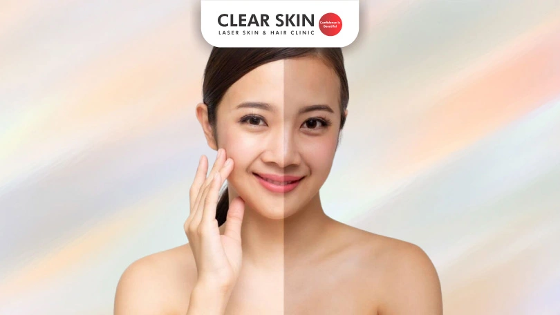 How to remove tan from face