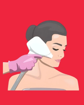 Conventional-Co2-Laser-Treatment-Procedure Conventional Co2 Laser Treatment Procedure