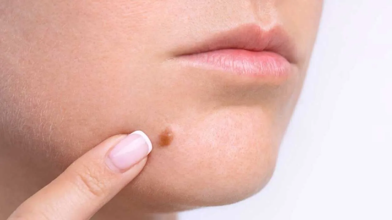 Moles Moles