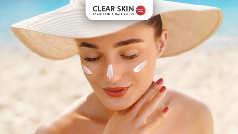 Shield Your Skin The Sunscreen Solution for Acne Prone Skin