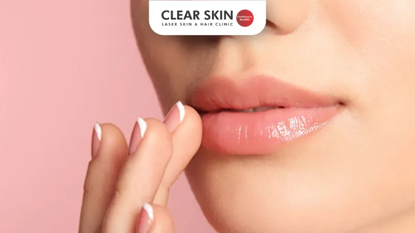 Tips-for-Keeping-Your-Lips-Hydrated-and-Healthy-Clear-Skin-Pune