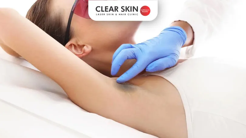 Treatment for dark armpits