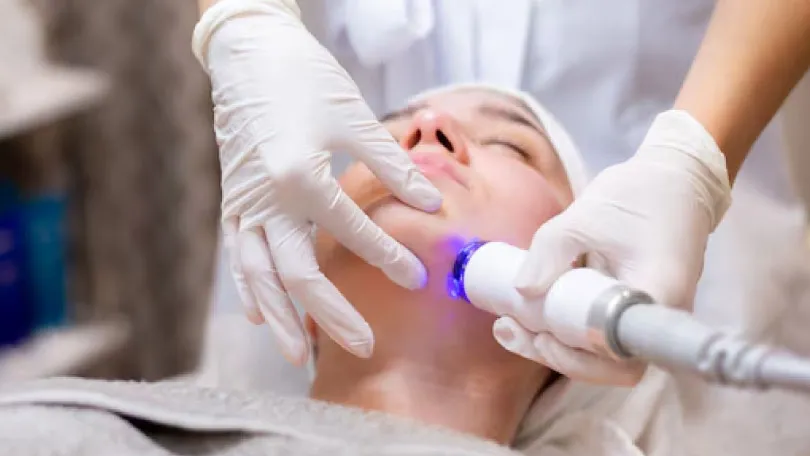 fotona laser treatment for skin