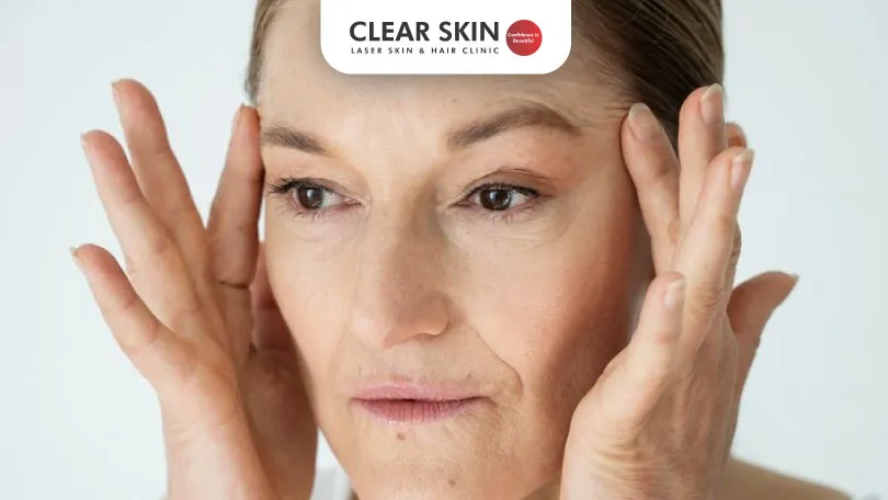 aging on skin