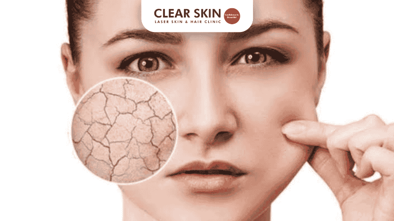 Dos and Don’ts of Skin Hydration | Healthy Skin Tips
