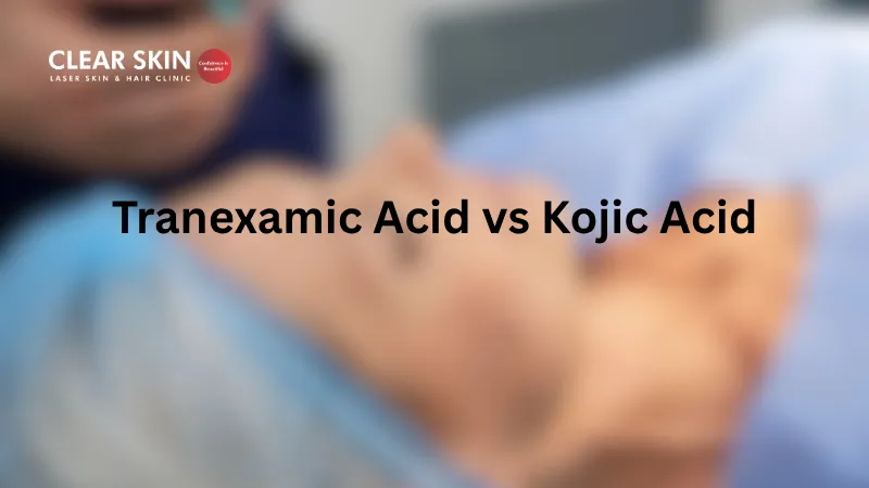 Tranexamic Acid vs Kojic Acid for Melasma: Which Is Safer for Indian Skin?