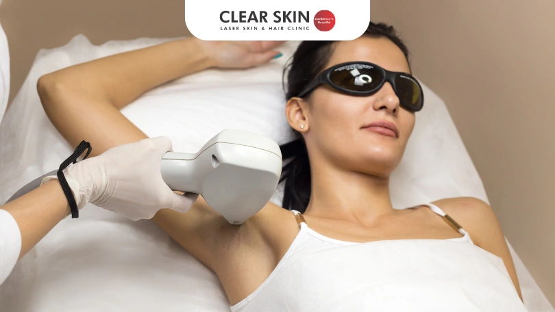 Laser Hair Removal in Pune –What Patients Say After 6 Sessions at Clear Skin