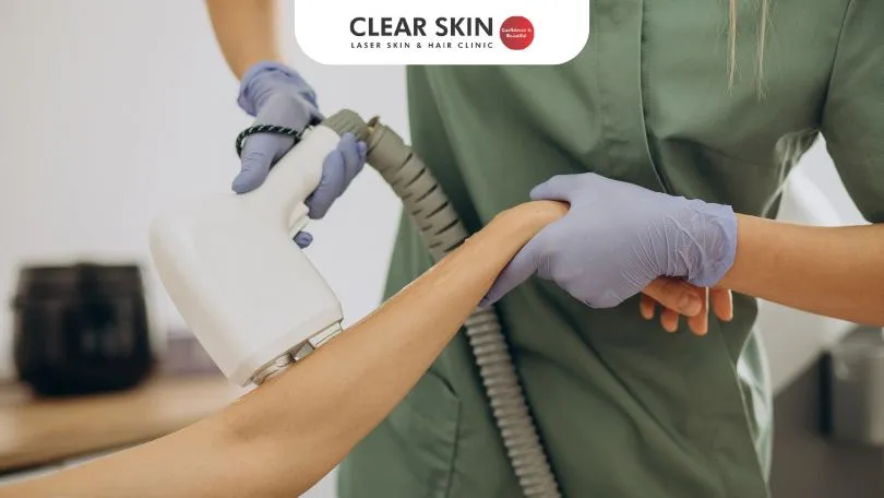 Laser hair removal for dark skin tones at Clear Skin Clinic Pune