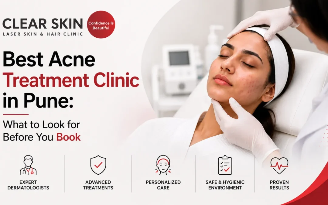 Best Acne Treatment Clinic in Pune: What to Look for Before You Book