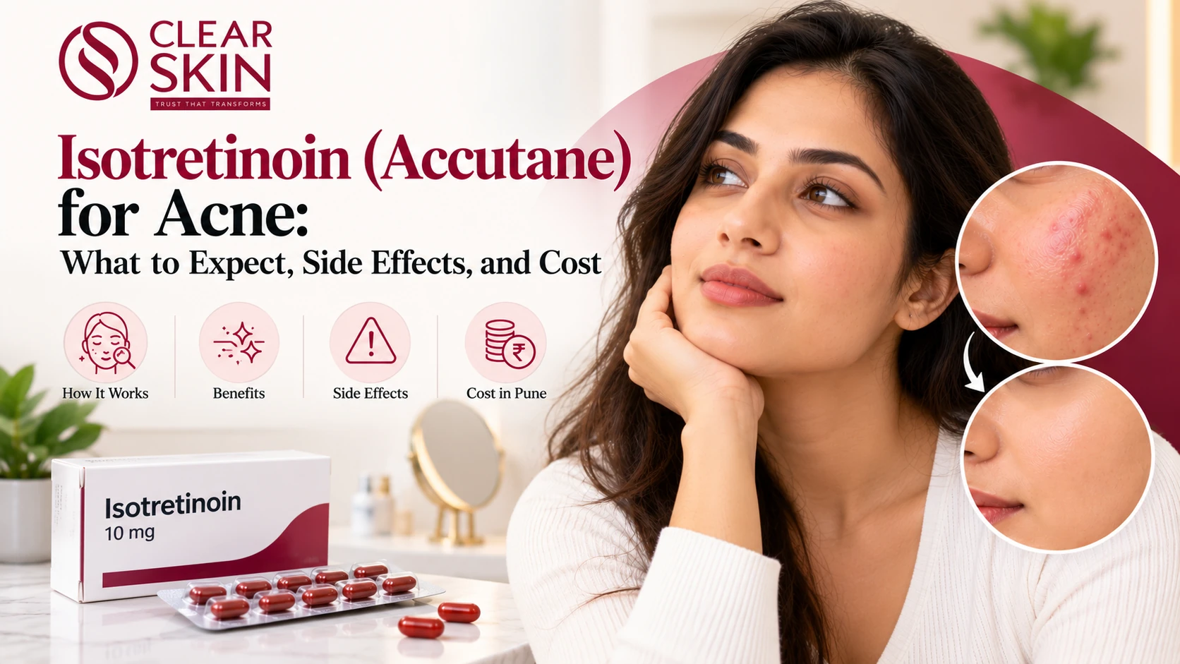 Isotretinoin (Accutane) for Acne: What to Expect, Side Effects, and Cost
